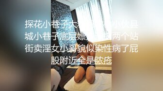 探花小巷子大粗屌农村小伙县城小巷子底层嫖妓连搞两个站街卖淫女小哥貌似染性病了屁股附近全是脓疮